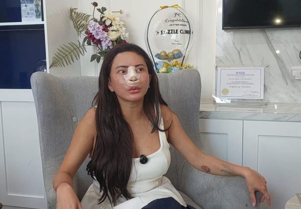 Demi Totalitas Peran di Film Horor Terbaru, Ayu Aulia Rela Operasi Hidung Pakai Tulang Iga Ayu Aulia